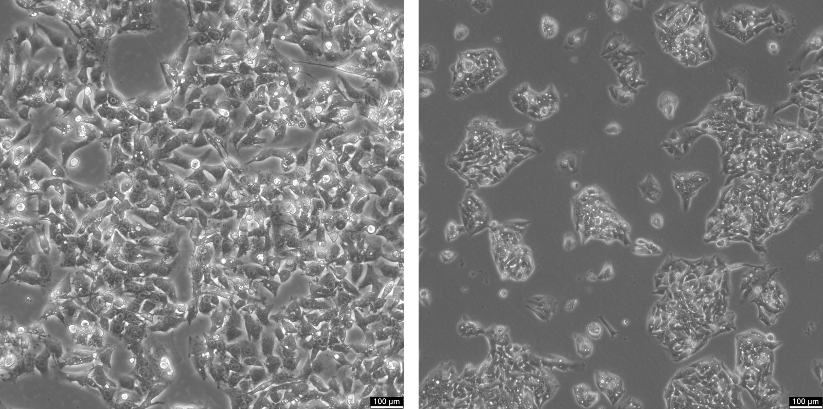 HepG2 Cells: Key to Liver Cancer and Metabolism Research